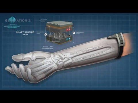 Bionics for Humanity: Disability is not An Option